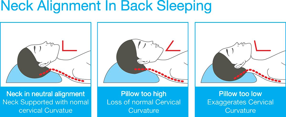 Neck-alignment-in-back-sleeping Neck alignment in back sleeping