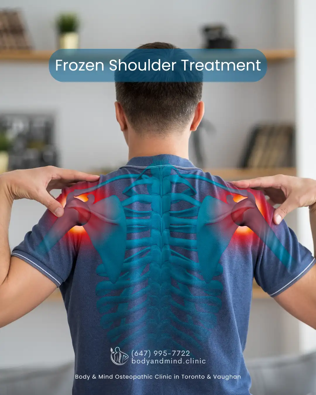 Frozen shoulder osteopathic techniques
