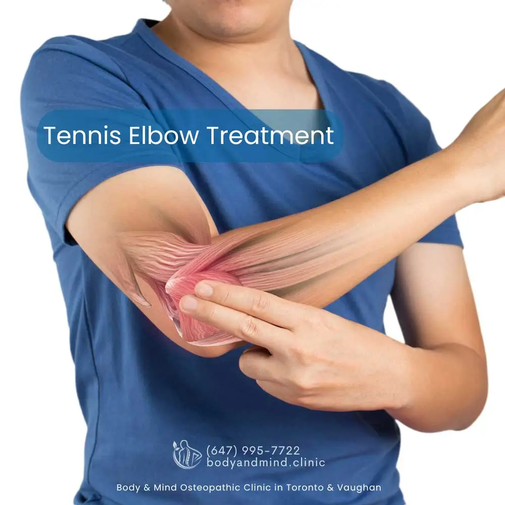 Tennis-Elbow-Treatment Tennis elbow treatment by osteopath